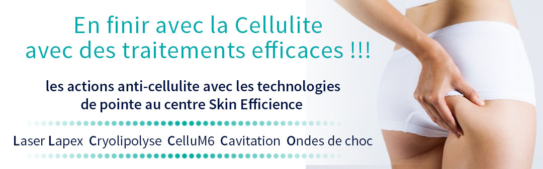 Les actions anti-cellulite Les traitements anti-cellulite au centre skin efficience Laser Lapex Cryolypolise cavitation ondes de choc